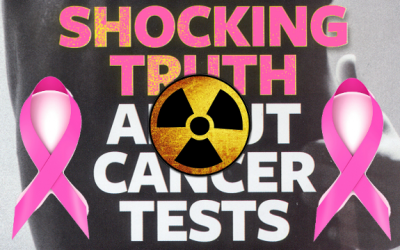 mammogram risk
