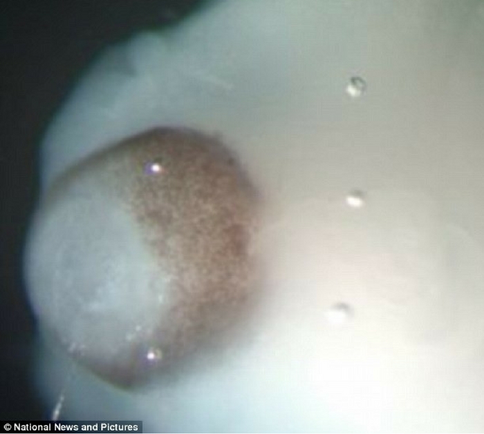 Source: Daily Mail A magnified picture of an organoid