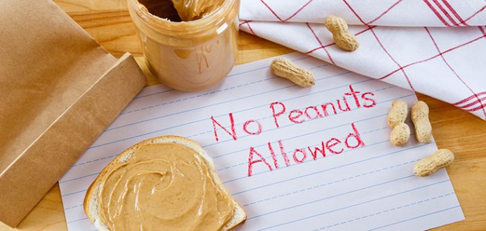 food allergies