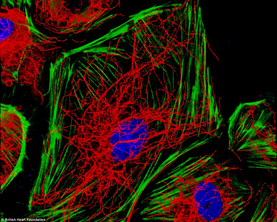 Cells which line blood vessels and reveals the proteins that provide support and shape to the cell.