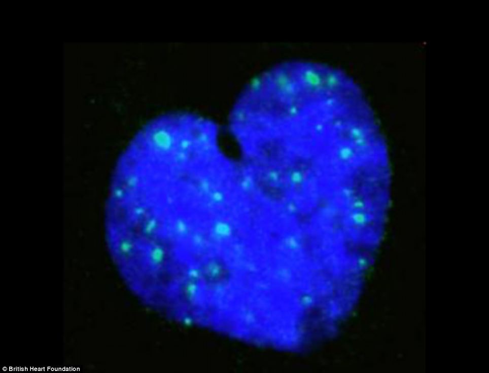 A nucleus from a single vascular smooth muscle cell.