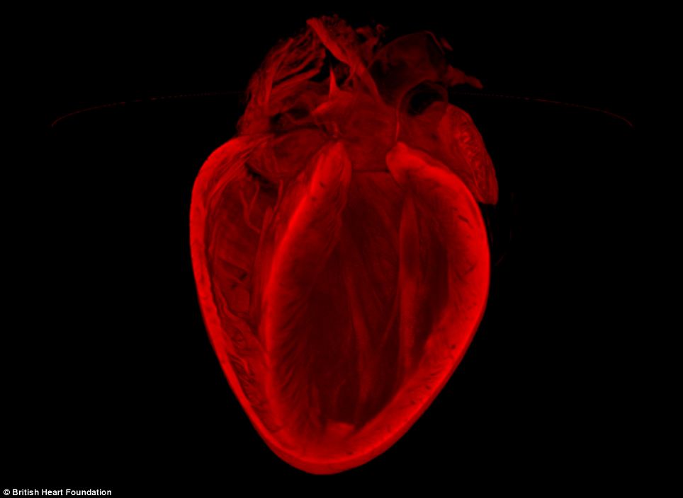 Image winner: 3D structure of an adult mouse heart.