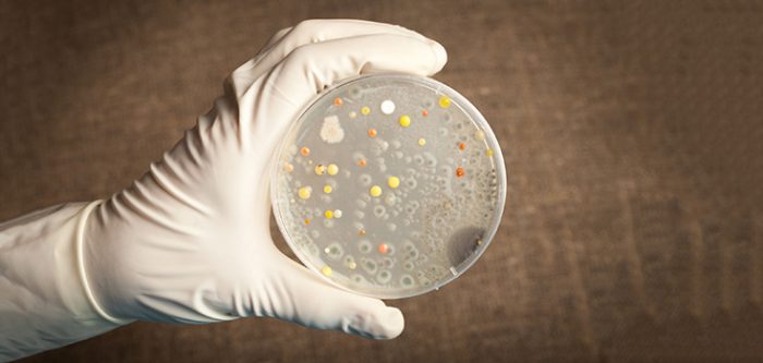 superbug bacteria