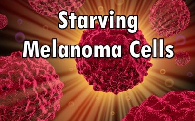 cancer cells