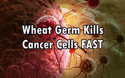cancer tumor