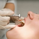 FDA Ignores Scientists, Dentists Warning of Amalgam Mercury Pandemic FDA Ignores Scientists, Dentists Warning of Amalgam Mercury Pandemic
