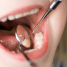 European Commission Recommends Banning Mercury Fillings European Commission Recommends Banning Mercury Fillings