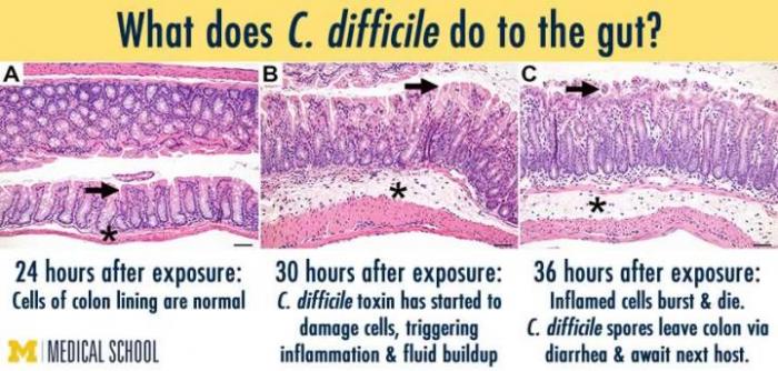 Source: Medical News Today