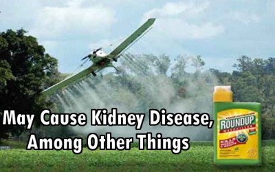 Roundup