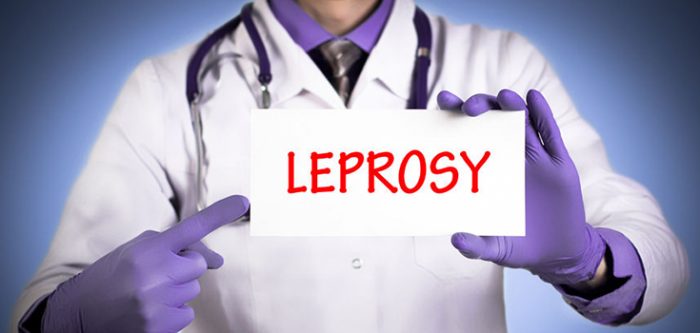 leprosy