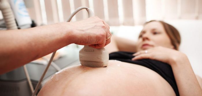 ultrasound