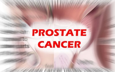 prostate cancer