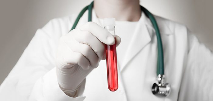 blood test tube