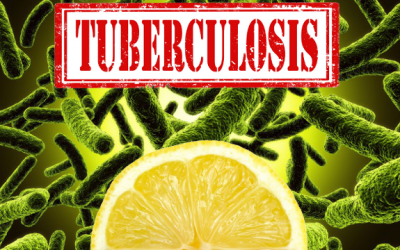 tuberculosis