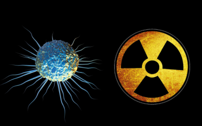 cancer tumor radiation