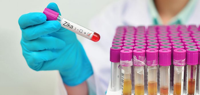 Zika virus diagnosis