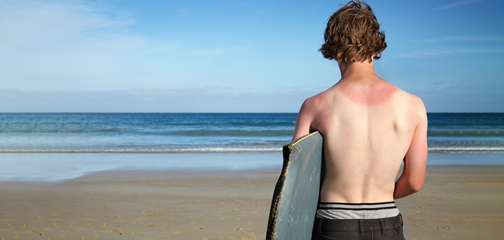 Prevent Sunburn Naturally by Consuming these Foods
