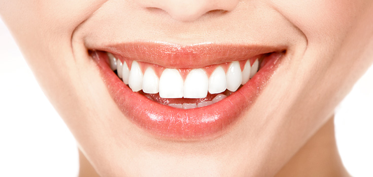 woman smiling with white teeth
