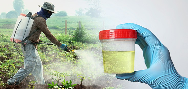 Glyphosate in Monsanto’s Roundup Found in All Urine Samples Tested