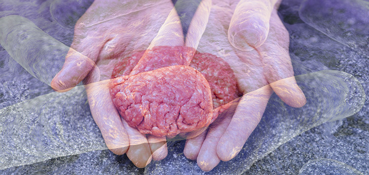 bacteria and meat