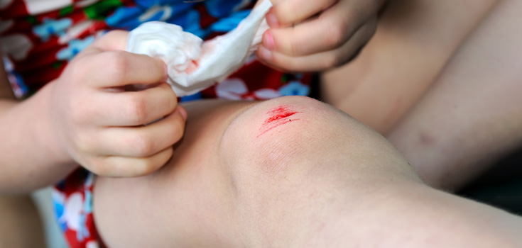 kid with cut on knee