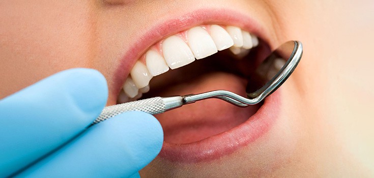 Dental Amalgam (Silver) Fillings and Cancer: Is there a Connection?
