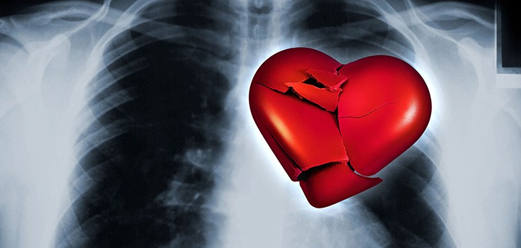 97% of Americans Have Unhealthy Hearts – Here are 7 Solutions