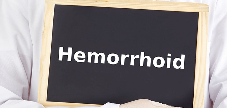 Home Remedies for Hemorrhoids – 6 Natural Treatments