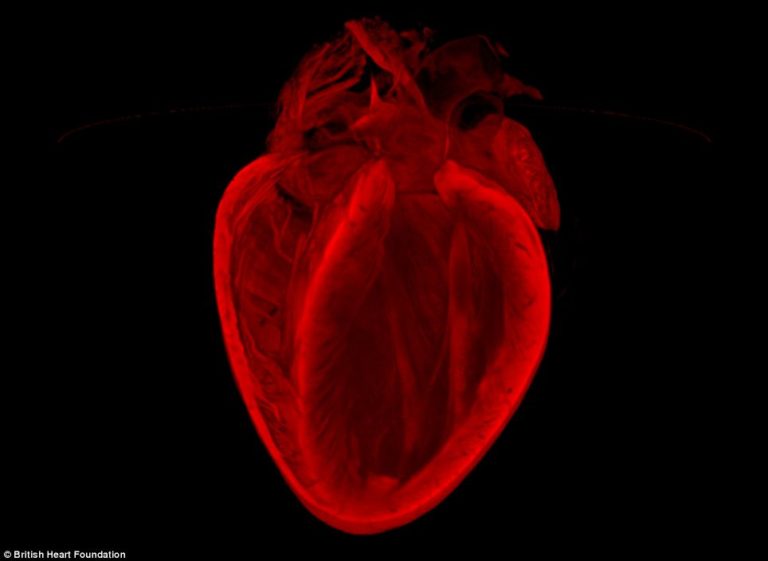 Here are Incredible Award-Winning Images of the Heart