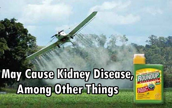 Monsanto’s Glyphosate Linked to Kidney Disease Epidemic in Poor Farming Regions