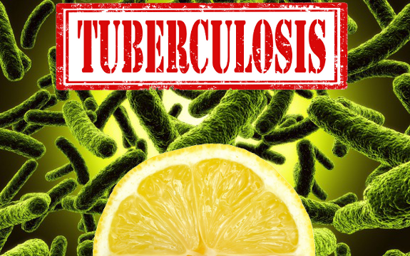 Study Shows Vitamin C Battles Antibiotic-Resistant Tuberculosis
