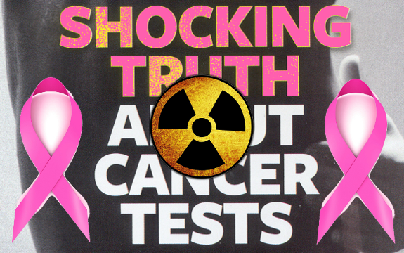 Women Given Radiation for Breast Cancer 8x more Likely to Develop Lung Cancer