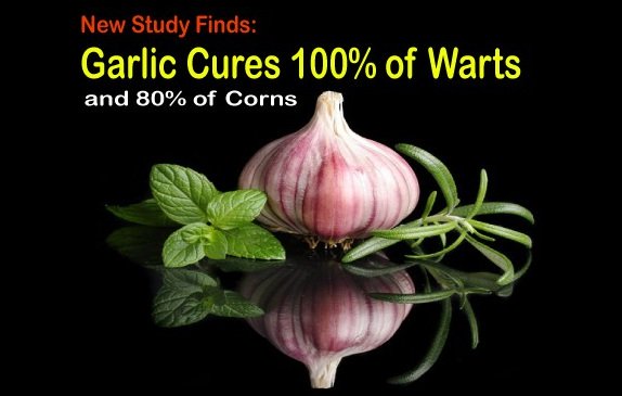 New Study Finds Garlic Heals 100% of Warts in 2 Weeks