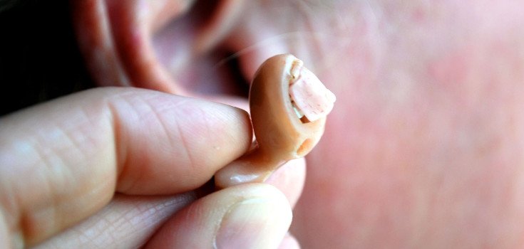 Could this Hormone be the Real Solution to Hearing Loss?