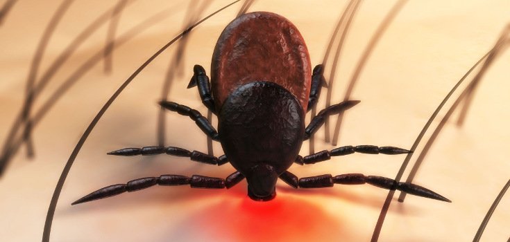Powassan Virus: ‘Ticks Now Carrying Virus Worse than Lyme Disease’