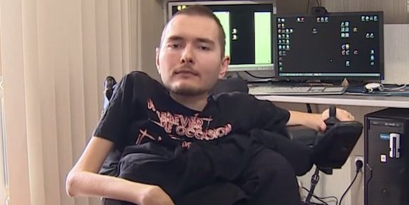 First Head Transplant Operation Aims for Immortality, Surgeon Says