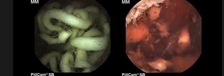 Watch: This Is What Happens Inside Your Body When You Eat Fast Food