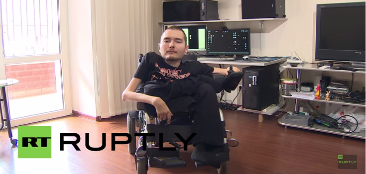 Russian Man with Spinal Cord Disease to Be First Recipient of Human Head Transplant