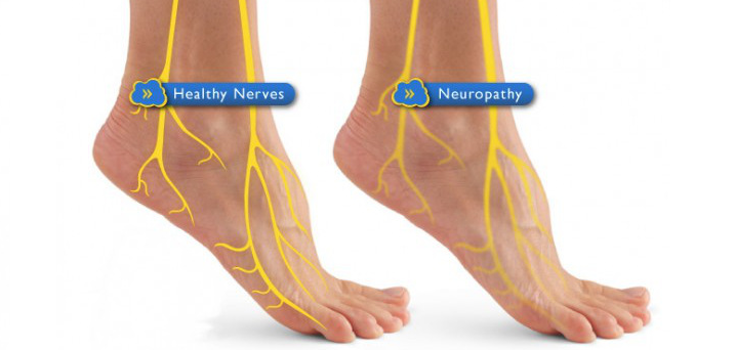 Diabetic Neuropathy CAN Be Treated! 6 Natural Solutions