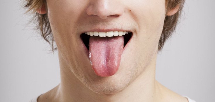 Tongue Scraping: A Relatively Unknown Yet Very Important Health Practice