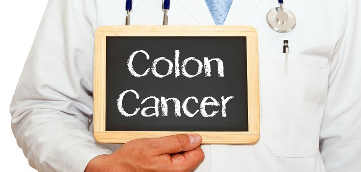 Colorectal Cancer is Widespread in Parts of the South (Map)