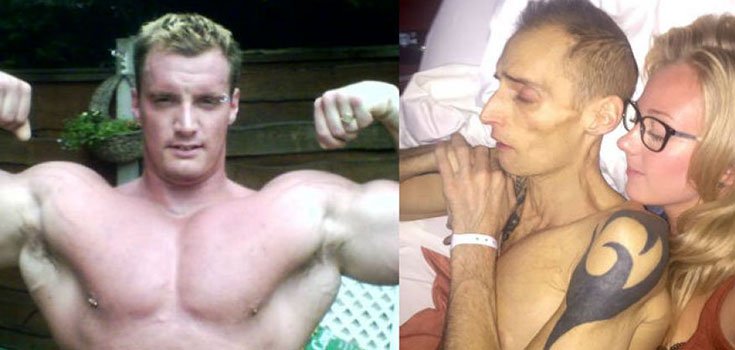 British Bodybuilder Consuming 7-8 Energy Drinks Daily Dies from Liver Cancer