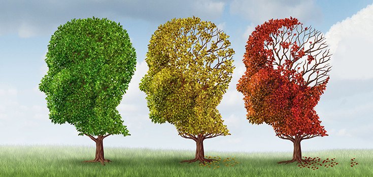 9 Surprising Risk Factors Associated with Alzheimer’s Disease