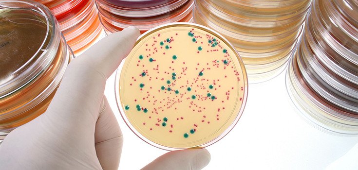 bacteria-petri-dish-lab-735-350