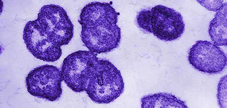 ‘Super Drug-Resistant Strain’ of Gonorrhea Sickens 12+ People in England