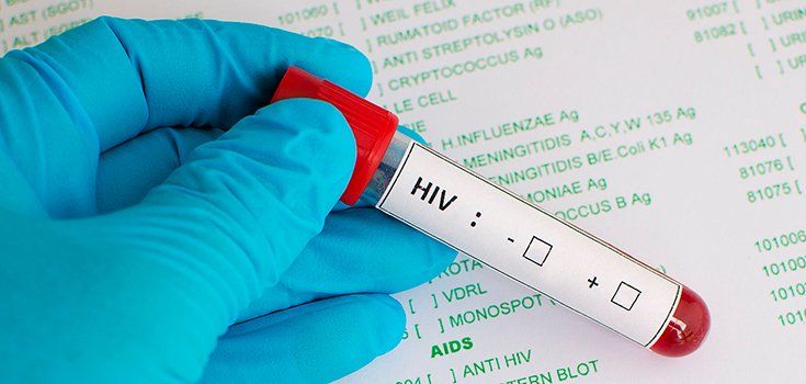 293 Patients at Mass. Hospital Possibly Exposed to HIV, Hepatitis