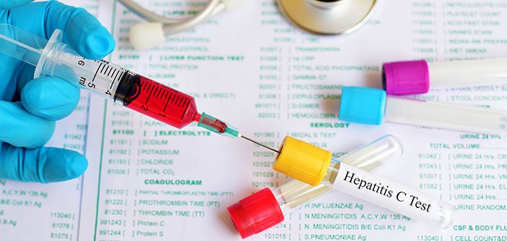 ER Nurse Causes Hepatitis C Outbreak at Utah Hospital