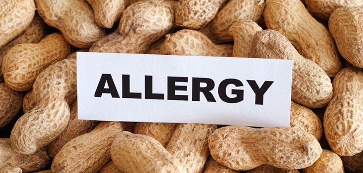 Exposure to Certain Foods in Infancy May Prevent Future Allergies