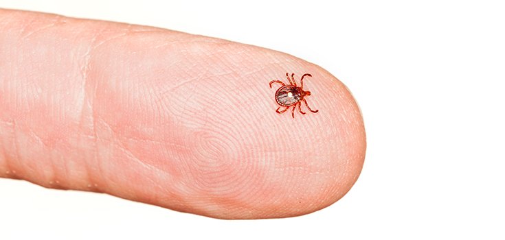 How to Keep Ticks off of You, and Get Rid of Them if Needed