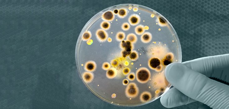 2nd Case of Superbug Resistant to All Drugs Found in NY Patient